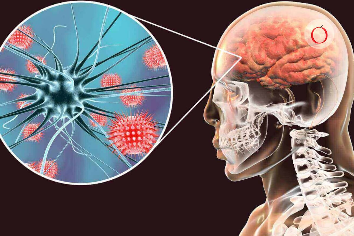 Alerta máxima en Reino Unido por brote de meningitis en Kent